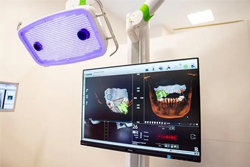 歯科用CTとインプラント手術ナビゲーションシステムを活用