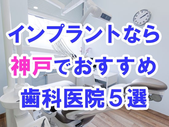 【2024年度版】神戸でインプラント治療するならおすすめの歯科医院５選